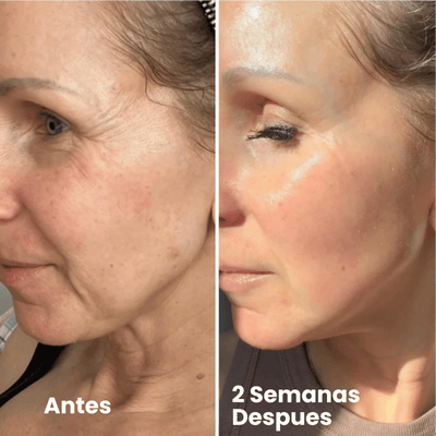 Velisse® Retinal Shot - Adiós Arrugas