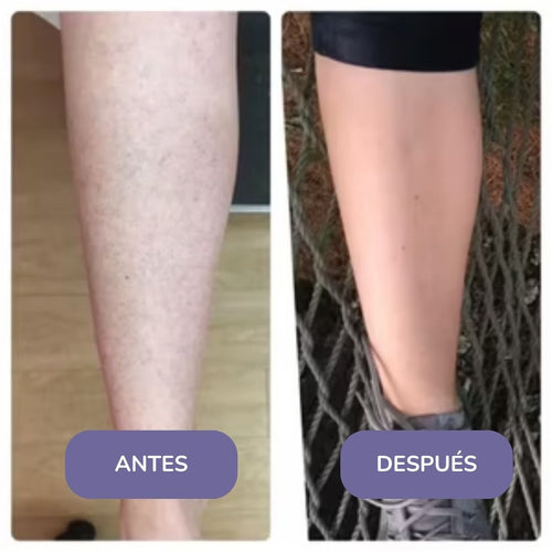Elinea® Crema Depilatoria Corporal