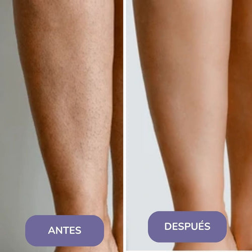 Elinea® Crema Depilatoria Corporal