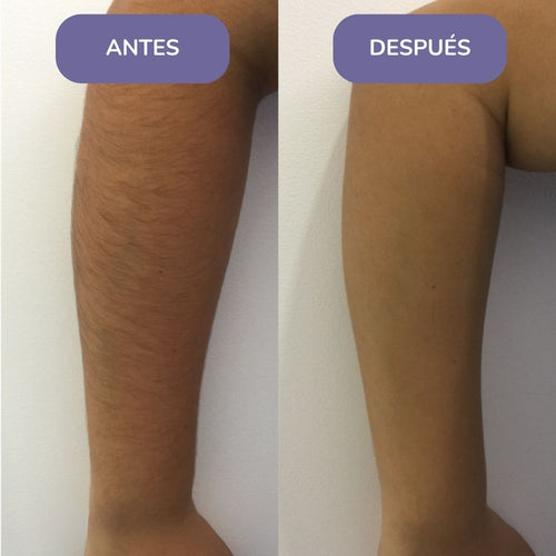 Elinea® Crema Depilatoria Corporal