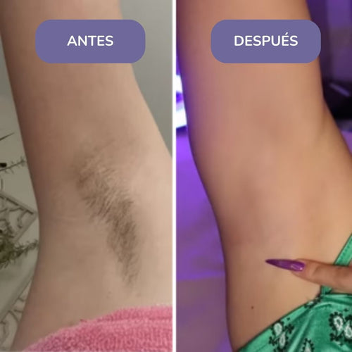 Elinea® Crema Depilatoria Corporal