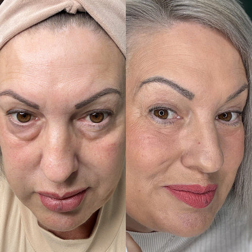 Parches Mágicos (30 Días) | Desaparece Ojeras y Bolsas en los Ojos