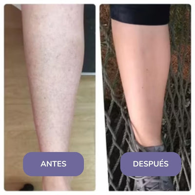 Elinea® Crema Depilatoria Corporal