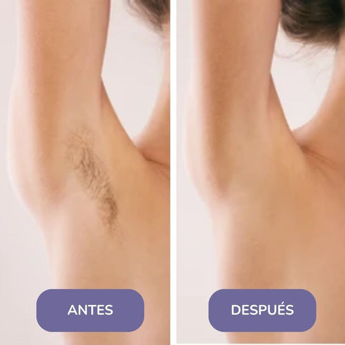 Elinea® Crema Depilatoria Corporal