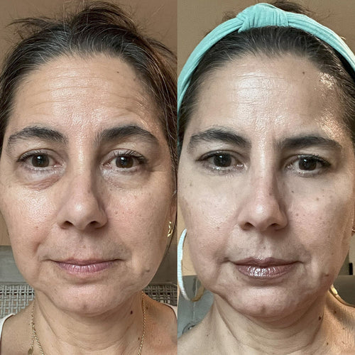 Parches Mágicos (30 Días) | Desaparece Ojeras y Bolsas en los Ojos
