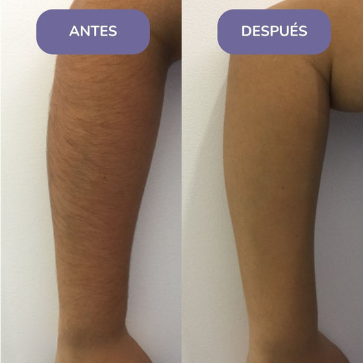 Elinea® Crema Depilatoria Corporal