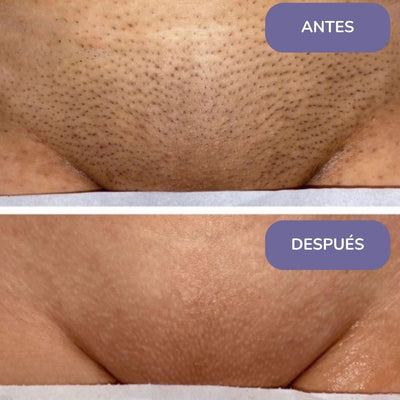 Elinea® Crema Depilatoria Corporal