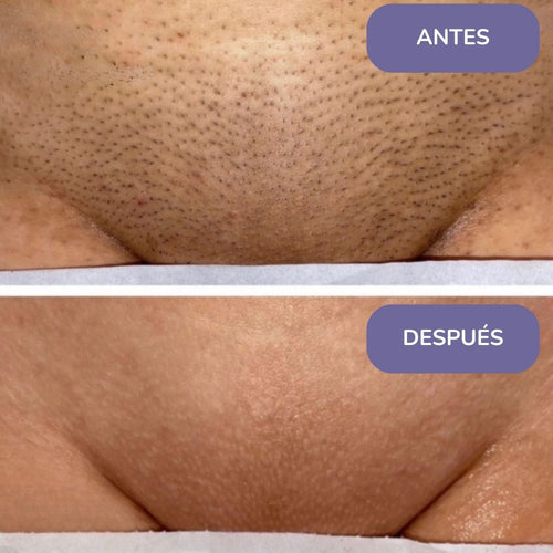 Elinea® Crema Depilatoria Corporal