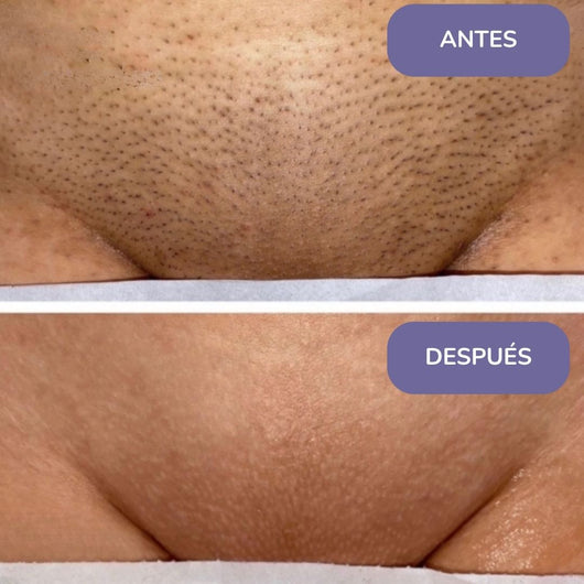 Elinea® Crema Depilatoria Corporal