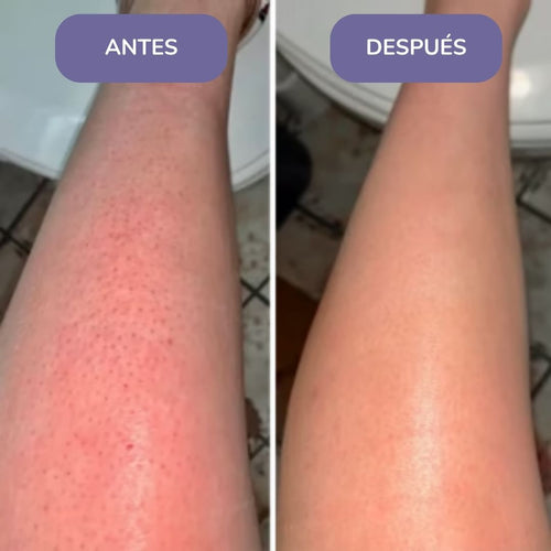 Elinea® Crema Depilatoria Corporal