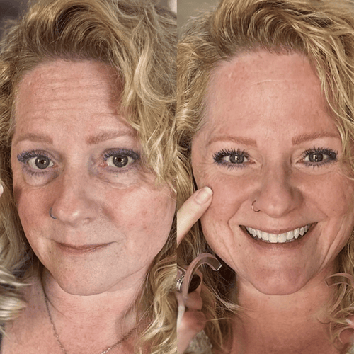 Parches Mágicos (30 Días) | Desaparece Ojeras y Bolsas en los Ojos